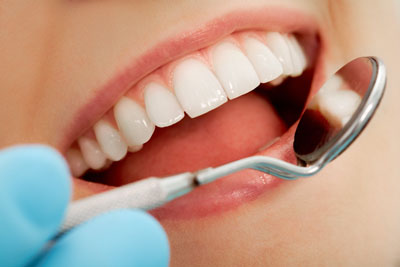 How Dental Bonding Can Improve Your Smile