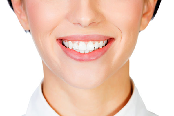 Dental Veneers